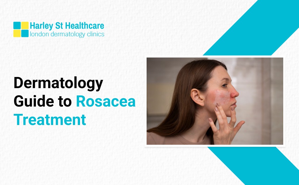 rosacea treatment dermatology