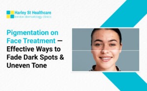 Pigmentation on Face Treatment — Effective Ways to Fade Dark Spots & Uneven Tone
