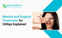 Vitiligo Treatment in London | Medical & Surgical Options Explained