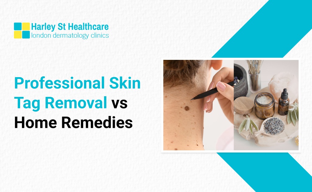Professional Skin Tag Removal vs Home Remedies&ndash;Safe &amp; Effective Options