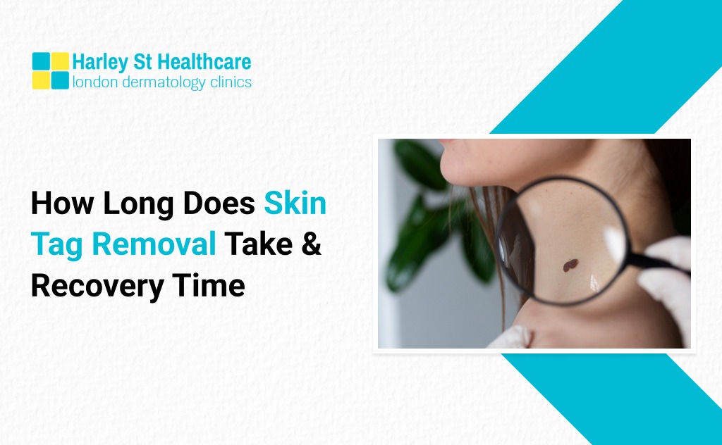 How Long Does Skin Tag Removal Take & Recovery Time
