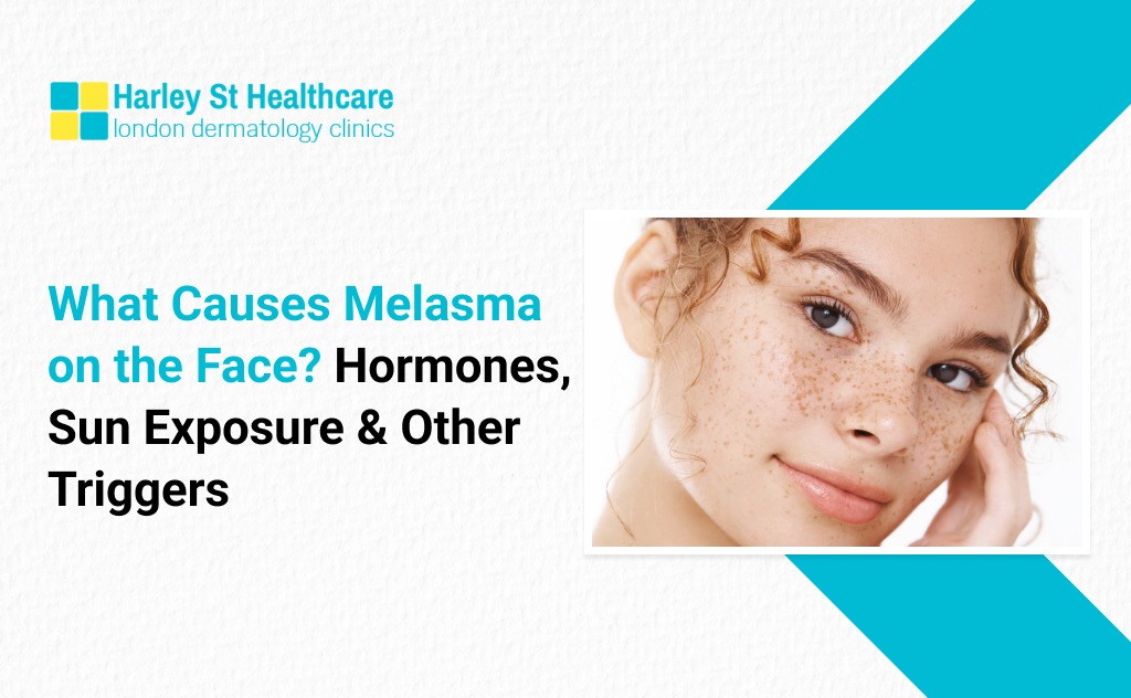 What Causes Melasma on the Face